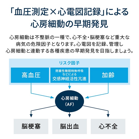 【オムロン】携帯型心電計 家庭で簡単に心電図の記録ができる